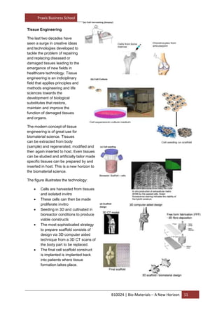 The most sophisticated strategy to prepare scaffold consists of design via 3D computer aided technique from a 3D CT scans of the body part to be replaced. 
