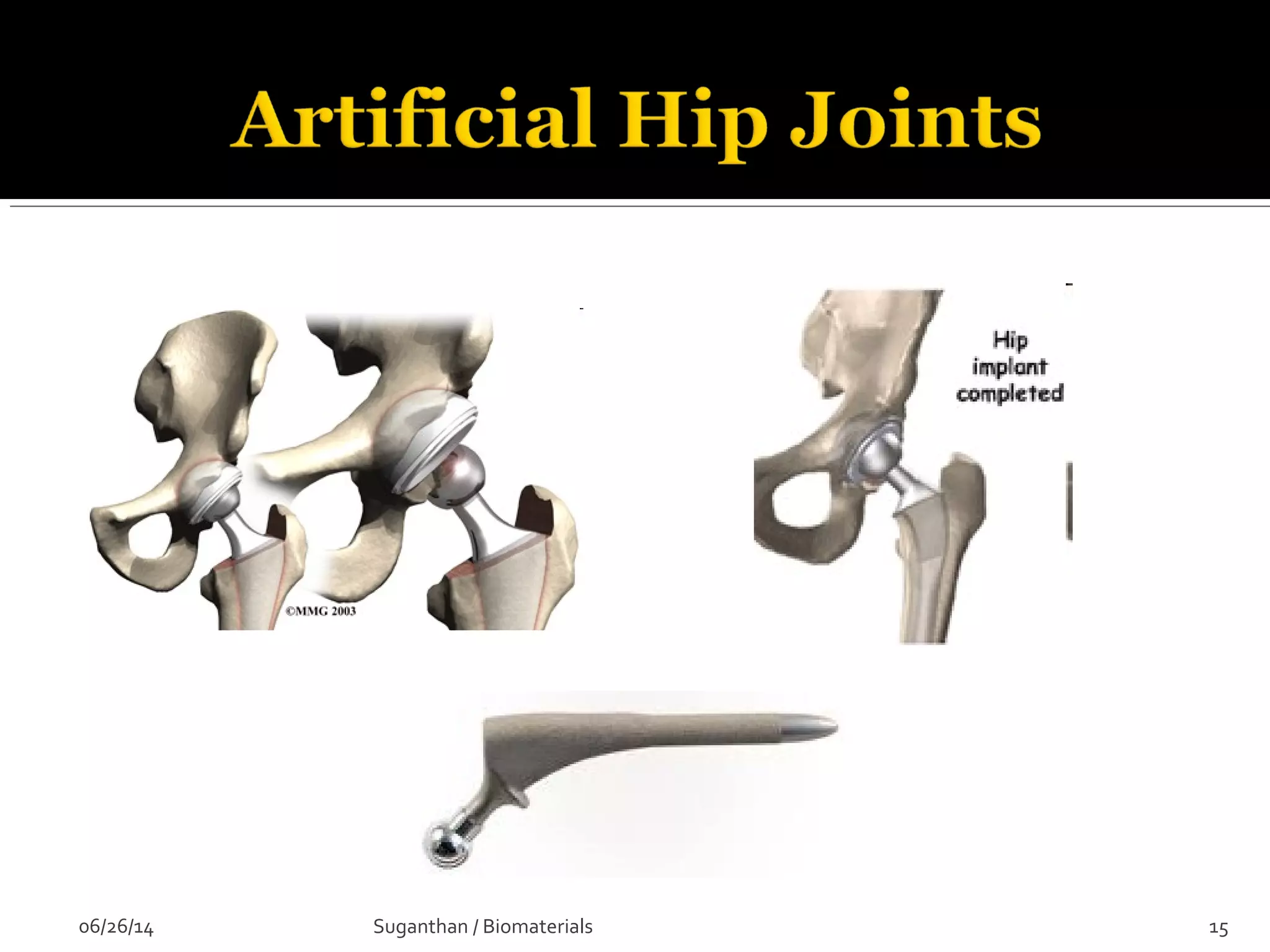 06/26/14 15Suganthan / Biomaterials
 