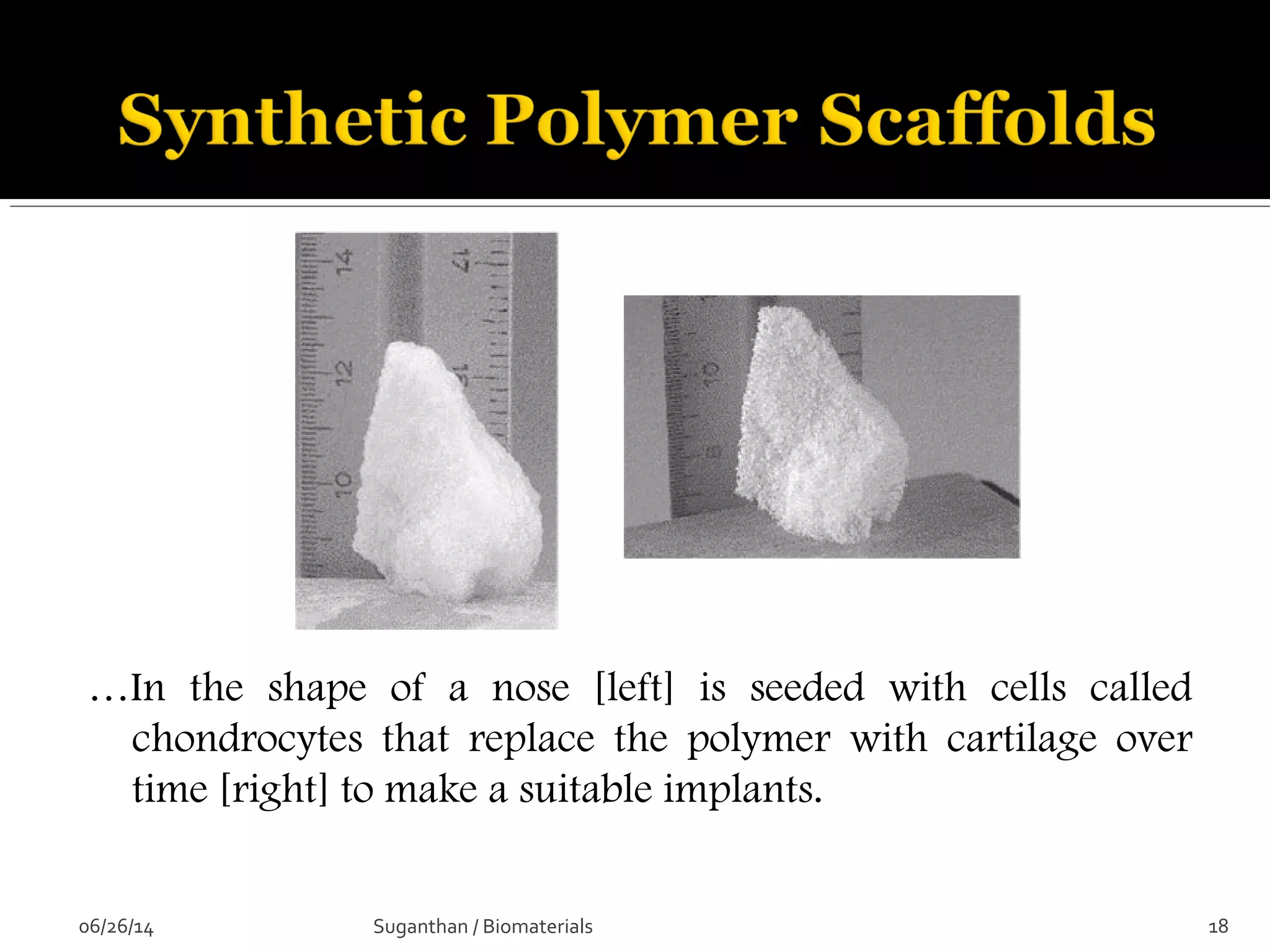 …In the shape of a nose [left] is seeded with cells called
chondrocytes that replace the polymer with cartilage over
time [right] to make a suitable implants.
06/26/14 18Suganthan / Biomaterials
 