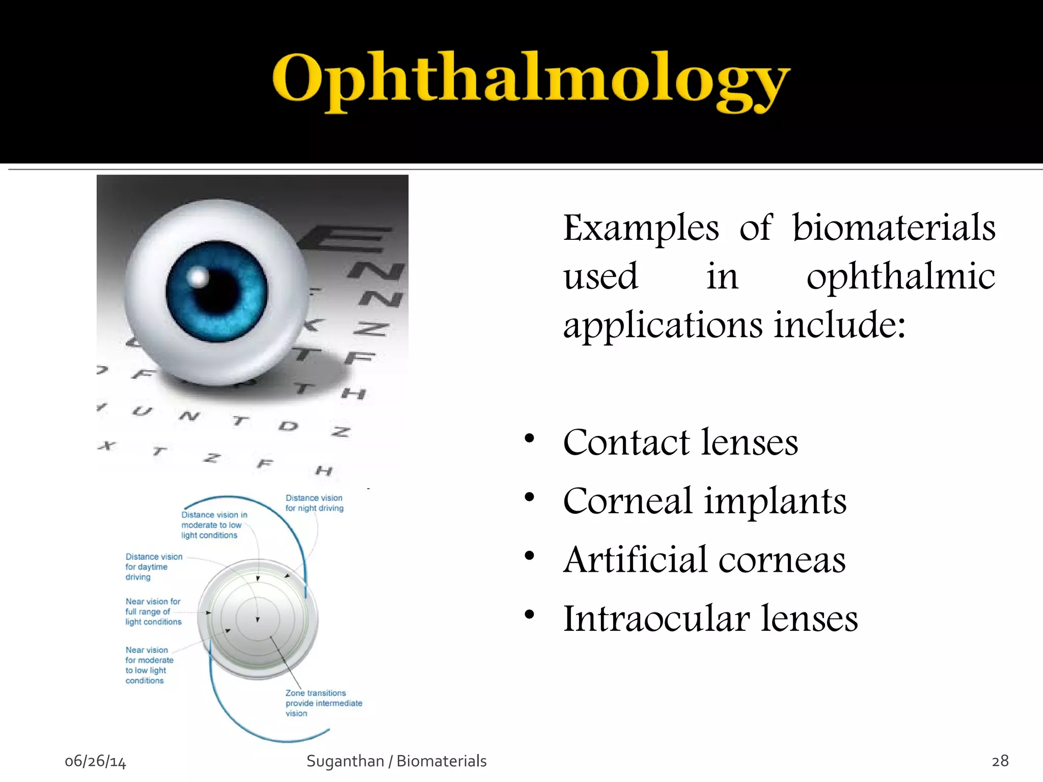 Examples of biomaterials
used in ophthalmic
applications include:
• Contact lenses
• Corneal implants
• Artificial corneas
• Intraocular lenses
06/26/14 28Suganthan / Biomaterials
 