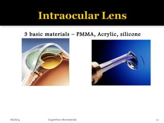 3 basic materials – PMMA, Acrylic, silicone
06/26/14 12Suganthan / Biomaterials
 