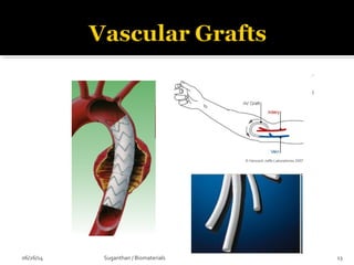 06/26/14 13Suganthan / Biomaterials
 