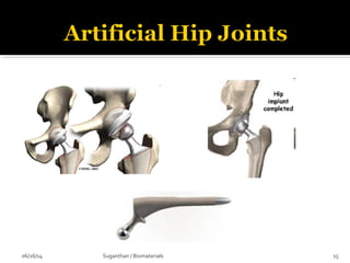 06/26/14 15Suganthan / Biomaterials
 