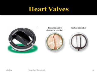 06/26/14 17Suganthan / Biomaterials
 