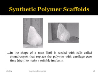 …In the shape of a nose [left] is seeded with cells called
chondrocytes that replace the polymer with cartilage over
time [right] to make a suitable implants.
06/26/14 18Suganthan / Biomaterials
 