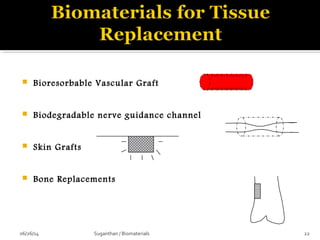  Bioresorbable Vascular Graft
 Biodegradable nerve guidance channel
 Skin Grafts
 Bone Replacements
06/26/14 22Suganthan / Biomaterials
 