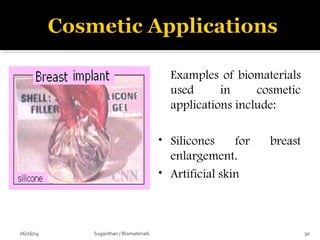 Examples of biomaterials
used in cosmetic
applications include:
• Silicones for breast
enlargement.
• Artificial skin
06/26/14 30Suganthan / Biomaterials
 