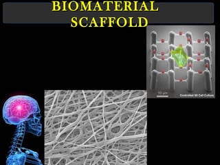 BIOMATERIALBIOMATERIAL
SCAFFOLDSCAFFOLD
 