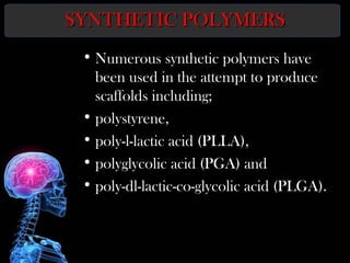SYNTHETIC POLYMERSSYNTHETIC POLYMERS
• Numerous synthetic polymers have
been used in the attempt to produce
scaffolds including;
• polystyrene,
• poly-l-lactic acid (PLLA),
• polyglycolic acid (PGA) and
• poly-dl-lactic-co-glycolic acid (PLGA).
 