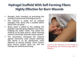 Hydrogel Scaffold With Self-Forming Fibers
Highly Effective for Burn Wounds
• Nanogel, that’s excellent at promoting the
healing of second and third degree burns.
• The material is made out of peptide
hydrogels that works like a scaffold within
which cells can grow.
• When water is added to this scaffold, the
peptides naturally group together into fibers,
trapping the water inside. This allows the
material to be both porous, while retaining
moisture that helps promote cellular growth.
• The researchers compared the material
against commonly used silicone dressings
and found it to be significantly more
effective at wound healing. There haven’t
been human studies done yet, but the
findings are certainly promising.
29
 