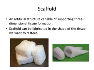 Scaffold
• An artificial structure capable of supporting three-
dimensional tissue formation.
• Scaffold can be fabricated in the shape of the tissue
we want to restore.
5
 