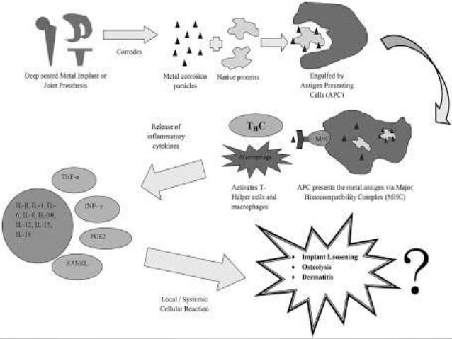 biomaterials-in-orthopaedics-ppt