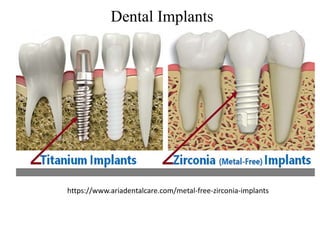 Dental Implants
https://www.ariadentalcare.com/metal-free-zirconia-implants
 