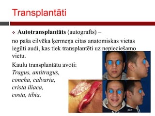 Transplantāti
 Autotransplantāts (autografts) –
no paša cilvēka ķermeņa citas anatomiskas vietas
iegūti audi, kas tiek transplantēti uz nepieciešamo
vietu.
Kaulu transplantātu avoti:
Tragus, antitragus,
concha, calvaria,
crista iliaca,
costa, tibia.
 