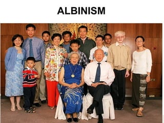 60Copyright © 2006-2011 Marshall Cavendish International (Singapore) Pte. Ltd.
ALBINISM
 