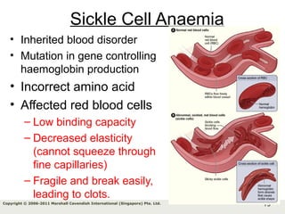 75Copyright © 2006-2011 Marshall Cavendish International (Singapore) Pte. Ltd.
Sickle Cell Anaemia
• Inherited blood disorder
• Mutation in gene controlling
haemoglobin production
• Incorrect amino acid
• Affected red blood cells
– Low binding capacity
– Decreased elasticity
(cannot squeeze through
fine capillaries)
– Fragile and break easily,
leading to clots.
 