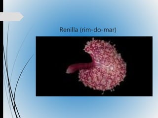 Renilla (rim-do-mar)
 
