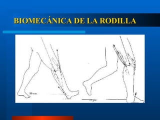 BIOMECÁNICA DE LA RODILLA 