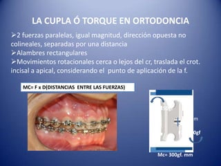 LA CUPLA Ó TORQUE EN ORTODONCIA
2 fuerzas paralelas, igual magnitud, dirección opuesta no
colineales, separadas por una distancia
Alambres rectangulares
Movimientos rotacionales cerca o lejos del cr, traslada el crot.
incisal a apical, considerando el punto de aplicación de la f.

    MC= F x D(DISTANCIAS ENTRE LAS FUERZAS)


                                                F1= 150gf
                                                              2 mm

                                                            F2= 150gf



                                                  Mc= 300gf. mm
 