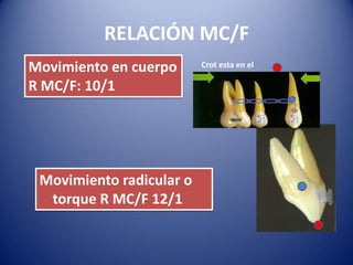 RELACIÓN MC/F
Movimiento en cuerpo      Crot esta en el
                             infinito
R MC/F: 10/1




 Movimiento radicular o
  torque R MC/F 12/1
 