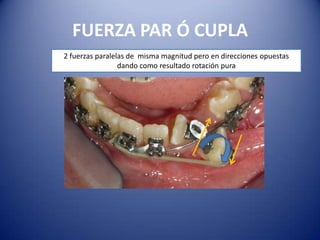 FUERZA PAR Ó CUPLA
2 fuerzas paralelas de misma magnitud pero en direcciones opuestas
                 dando como resultado rotación pura
 