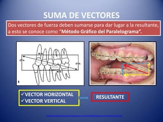 SUMA DE VECTORES
Dos vectores de fuerza deben sumarse para dar lugar a la resultante,
a esto se conoce como “Método Gráfico del Paralelograma”.




     VECTOR HORIZONTAL                                           RESULTANTE
     VECTOR VERTICAL

                 http://ortodonciavirtual3.blogspot.com/2010/08/elasticos-en-ortodoncia.html
 