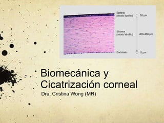 Biomecánica y
Cicatrización corneal
Dra. Cristina Wong (MR)
 