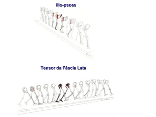 Tensor da Fáscia LataTensor da Fáscia Lata
Ilio-psoasIlio-psoas
 