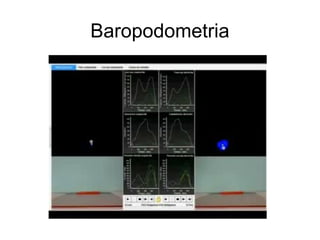 Baropodometria
 