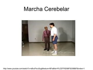 Marcha Cerebelar
http://www.youtube.com/watch?v=eBvzFkcvScg&feature=BFa&list=PLCEFF6D98F5039B6F&index=1
 