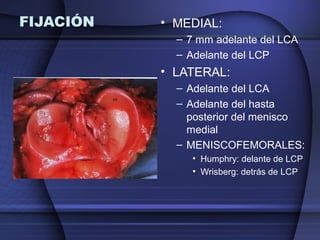 FIJACIÓN • MEDIAL: 
– 7 mm adelante del LCA 
– Adelante del LCP 
• LATERAL: 
– Adelante del LCA 
– Adelante del hasta 
posterior del menisco 
medial 
– MENISCOFEMORALES: 
• Humphry: delante de LCP 
• Wrisberg: detrás de LCP 
 