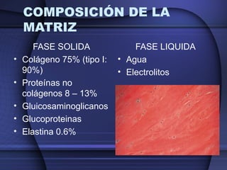 COMPOSICIÓN DE LA 
MATRIZ 
FASE SOLIDA 
• Colágeno 75% (tipo I: 
90%) 
• Proteínas no 
colágenos 8 – 13% 
• Gluicosaminoglicanos 
• Glucoproteinas 
• Elastina 0.6% 
FASE LIQUIDA 
• Agua 
• Electrolitos 
 