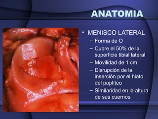 ANATOMIA 
• MENISCO LATERAL 
– Forma de O 
– Cubre el 50% de la 
superficie tibial lateral 
– Movilidad de 1 cm 
– Disrupción de la 
inserción por el hiato 
del poplíteo 
– Similaridad en la altura 
de sus cuernos 
 