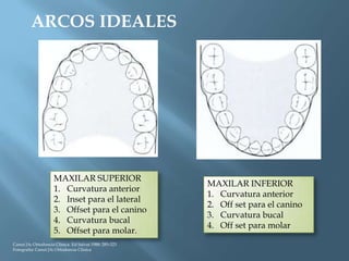 ARCOS IDEALES
MAXILAR SUPERIOR
1. Curvatura anterior
2. Inset para el lateral
3. Offset para el canino
4. Curvatura bucal
5. Offset para molar.
MAXILAR INFERIOR
1. Curvatura anterior
2. Off set para el canino
3. Curvatura bucal
4. Off set para molar
Canut JA: Ortodoncia Clinica. Ed Salvat 1988: 285-323
Fotografía: Canut JA: Ortodoncia Clinica
 