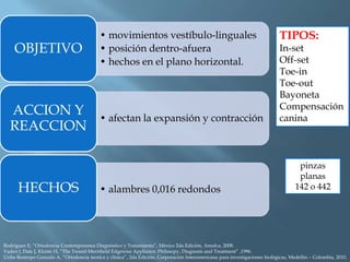 • movimientos vestíbulo-linguales
• posición dentro-afuera
• hechos en el plano horizontal.
OBJETIVO
• afectan la expansión y contracción
ACCION Y
REACCION
• alambres 0,016 redondos
HECHOS
TIPOS:
In-set
Off-set
Toe-in
Toe-out
Bayoneta
Compensación
canina
Rodriguez E, “Ortodoncia Contemporanea Diagnóstico y Tratamiento”, México 2da Edición, Amolca, 2008.
Vaden J, Dale J, Klonts H, “The Tweed-Merrifield Edgewise Appliance: Philosopy, Diagnosis and Treatment” ,1996.
Uribe Restrepo Gonzalo A, “Ortodoncia teorica y clinica”, 2da Edición, Corporación Interamericana para investigaciones biológicas, Medellín – Colombia, 2010.
pinzas
planas
142 o 442
 