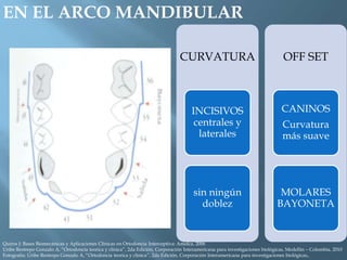 EN EL ARCO MANDIBULAR
CURVATURA
INCISIVOS
centrales y
laterales
sin ningún
doblez
OFF SET
CANINOS
Curvatura
más suave
MOLARES
BAYONETA
Quiros J: Bases Biomecánicas y Aplicaciones Clínicas en Ortodoncia Interceptiva: Amolca, 2006
Uribe Restrepo Gonzalo A, “Ortodoncia teorica y clinica”, 2da Edición, Corporación Interamericana para investigaciones biológicas, Medellín – Colombia, 2010
Fotografía: Uribe Restrepo Gonzalo A, “Ortodoncia teorica y clinica”, 2da Edición, Corporación Interamericana para investigaciones biológicas,.
 