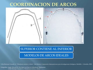 COORDINACION DE ARCOS
SUPERIOR CONTIENE AL INFERIOR
MODELOS DE ARCOS IDEALES
Uribe Restrepo Gonzalo A, “Ortodoncia teorica y clinica”, 2da Edición, Corporación Interamericana para investigaciones biológicas, Medellín – Colombia, 2010
Fotografías: Angle, Edward H; The Latest and Best in Orthodontic Mechanism
Uribe Restrepo Gonzalo A, “Ortodoncia teorica y clinica
 