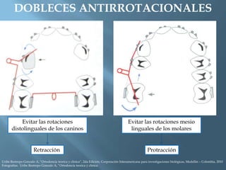 DOBLECES ANTIRROTACIONALES
Evitar las rotaciones
distolinguales de los caninos
Retracción
Evitar las rotaciones mesio
linguales de los molares
Protracción
Uribe Restrepo Gonzalo A, “Ortodoncia teorica y clinica”, 2da Edición, Corporación Interamericana para investigaciones biológicas, Medellín – Colombia, 2010
Fotografías: Uribe Restrepo Gonzalo A, “Ortodoncia teorica y clinica
 
