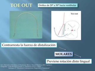 TOE OUT Doblez de 20° a 30° hacia vestibular
Contrarresta la fuerza de distalización
MOLARES
Previene rotación disto lingual
Ito J, Alternativas Mecánicas en Ortodoncia. México: Manual Moderno, 2002. Capítulo 2.
Fotografías: Uribe Restrepo Gonzalo A, “Ortodoncia teorica y clinica
Rodriguez E, “Ortodoncia Contemporanea Diagnóstico y Tratamiento”
 