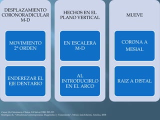 DESPLAZAMIENTO
CORONORADICULAR
M-D
MOVIMIENTO
2° ORDEN
ENDEREZAR EL
EJE DENTARIO
HECHOS EN EL
PLANO VERTICAL
EN ESCALERA
M-D
AL
INTRODUCIRLO
EN EL ARCO
MUEVE
CORONA A
MESIAL
RAIZ A DISTAL
Canut JA: Ortodoncia Clinica. Ed Salvat 1988: 285-323
Rodriguez E, “Ortodoncia Contemporanea Diagnóstico y Tratamiento”, México 2da Edición, Amolca, 2008
 