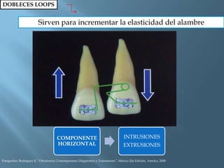 DOBLECES LOOPS
Sirven para incrementar la elasticidad del alambre
COMPONENTE
HORIZONTAL
INTRUSIONES
EXTRUSIONES
Fotografías: Rodriguez E, “Ortodoncia Contemporanea Diagnóstico y Tratamiento”, México 2da Edición, Amolca, 2008
 