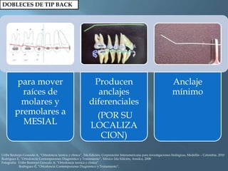 DOBLECES DE TIP BACK
para mover
raíces de
molares y
premolares a
MESIAL
Producen
anclajes
diferenciales
(POR SU
LOCALIZA
CION)
Anclaje
mínimo
Uribe Restrepo Gonzalo A, “Ortodoncia teorica y clinica”, 2da Edición, Corporación Interamericana para investigaciones biológicas, Medellín – Colombia, 2010
Rodriguez E, “Ortodoncia Contemporanea Diagnóstico y Tratamiento”, México 2da Edición, Amolca, 2008
Fotografía: Uribe Restrepo Gonzalo A, “Ortodoncia teorica y clinica”
Rodriguez E, “Ortodoncia Contemporanea Diagnóstico y Tratamiento”,
 