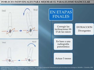 DOBLECES INDIVIDUALES PARA MEJORAR EL PARALELISMO RADICULAR
EN ETAPAS
FINALES
Corregir las
inclinaciones M-
D de las raíces
En base a una
radiografía
panorámica
EXTRACCION
Divergentes
Actuar 3 meses
Uribe Restrepo Gonzalo A, “Ortodoncia teorica y clinica”, 2da Edición, Corporación Interamericana para investigaciones biológicas, Medellín – Colombia, 2010
Fotografía: Uribe Restrepo Gonzalo A, “Ortodoncia teorica y clinica”
 