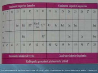 Uribe Restrepo Gonzalo A, “Ortodoncia teorica y clinica”, 2da Edición, Corporación Interamericana para investigaciones biológicas, Medellín – Colombia, 2010
 