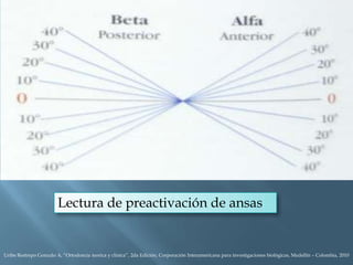 Lectura de preactivación de ansas
Uribe Restrepo Gonzalo A, “Ortodoncia teorica y clinica”, 2da Edición, Corporación Interamericana para investigaciones biológicas, Medellín – Colombia, 2010
 
