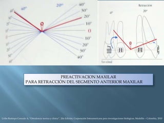 PREACTIVACION MAXILAR
PARA RETRACCIÓN DEL SEGMENTO ANTERIOR MAXILAR
Uribe Restrepo Gonzalo A, “Ortodoncia teorica y clinica”, 2da Edición, Corporación Interamericana para investigaciones biológicas, Medellín – Colombia, 2010
 