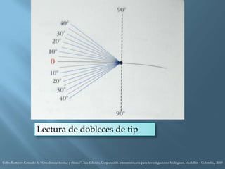 Lectura de dobleces de tip
Uribe Restrepo Gonzalo A, “Ortodoncia teorica y clinica”, 2da Edición, Corporación Interamericana para investigaciones biológicas, Medellín – Colombia, 2010
 
