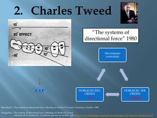 “The systems of
directional force” 1980
Movimiento
controlado
DOBLECES 3ER.
ORDEN
TORQUE
DOBLECES 2DO.
ORDEN
TIP
Merrifield L, The systems of directional force, Meeting of Charles H Tweed, Tennessee, October, 1980.
Fotografías:. The systems of directional force, Meeting of Charles H Tweed
«Historia de la ortodoncia. La historia que áun se escribe» pdf, http://www.hospitalgea.salud.gob.mx/descargas/Art_Historia_Ortodoncia.pdf
 
