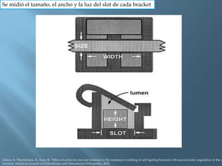 Se midió el tamaño, el ancho y la luz del slot de cada bracket
Glenys A. Thorstenson, B,. Kusy R, “Effect of archwire size and material on the resistance to sliding of self ligating brackets with second-order angulation in the d
revision, American Journal of Orthodontics and Dentofacial Orthopedics, 2002
 