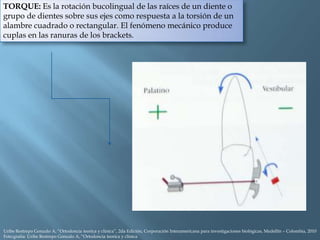 TORQUE: Es la rotación bucolingual de las raíces de un diente o
grupo de dientes sobre sus ejes como respuesta a la torsión de un
alambre cuadrado o rectangular. El fenómeno mecánico produce
cuplas en las ranuras de los brackets.
Uribe Restrepo Gonzalo A, “Ortodoncia teorica y clinica”, 2da Edición, Corporación Interamericana para investigaciones biológicas, Medellín – Colombia, 2010
Foto:grafía: Uribe Restrepo Gonzalo A, “Ortodoncia teorica y clinica
 